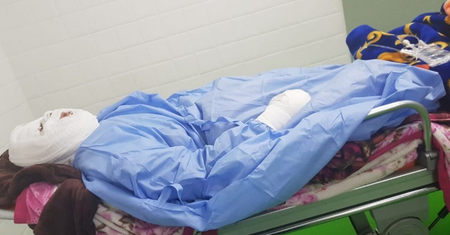 Wylał na żonę wrzący olej, kiedy kobieta spała. Ofiara ataku ledwo przeżyła