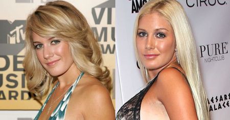 Heidi Montag: największa ofiara operacji plastycznych w Hollywood
