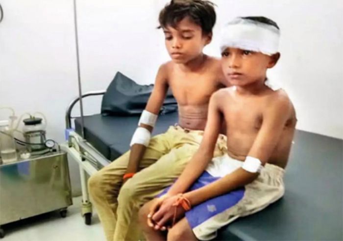 14-latek uratował 7-letniego kuzyna z pazurów lamparta
