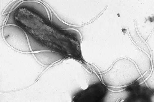 Zdjęcie mikroskopowe Helicobacter pylori