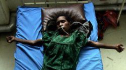 Kobieta chora na AIDS - Papua Nowa Gwinea