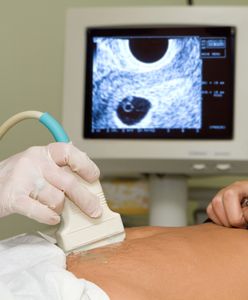 Dzieci poddane aborcji na sprzedaż