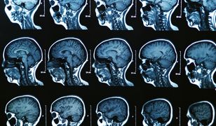 Na chorobach znamy się wszyscy. Czy rzeczywiście? Quiz!