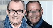 Rafał Bryndal po wielu latach poddał się operacji nosa. Efekt? Nie do poznania!