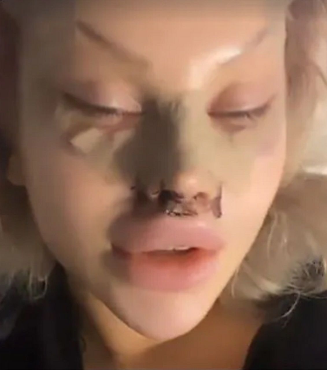 Ewelina Kubiak po operacji nosa