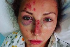 Polska olimpijka potrącona przez minibusa. Dramatyczny wypadek podczas treningu