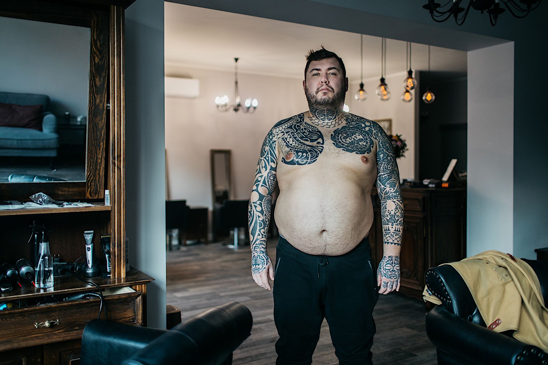 Maciek musiał przytyć 20 kg, żeby lekarz zakwalifikował go do operacji. 
