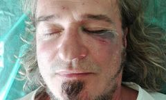 Znany wokalista brutalnie pobity. "Trzech na jednego, od tyłu, bez ostrzeżenia"