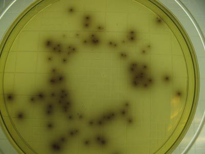 Obraz bakterii listeria monocytogenes 