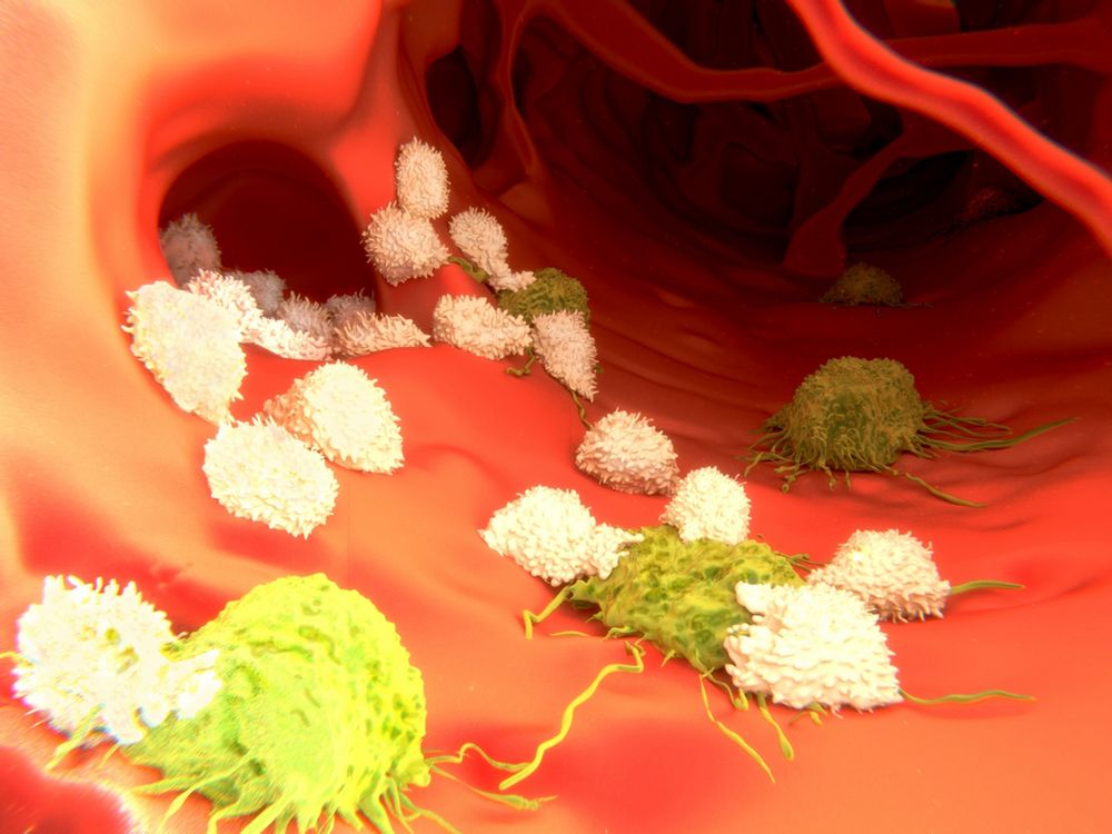 Immunoterapia wyleczy raka całkowicie 