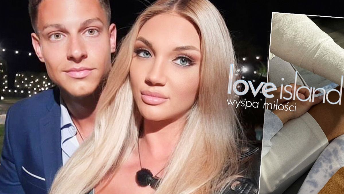 Mateusz z "Love Island" miał groźny wypadek. Połamany leży w domu. Pokazał zdjęcia, na które aż przykro patrzeć