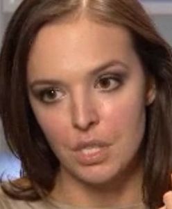 Anna Wendzikowska w "Klinice Urody" wypełniła sobie bruzdy