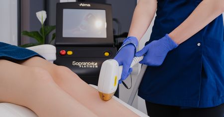 Poznaj sekrety skutecznej depilacji laserowej