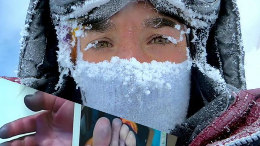 Himalaistce grozi amputacja