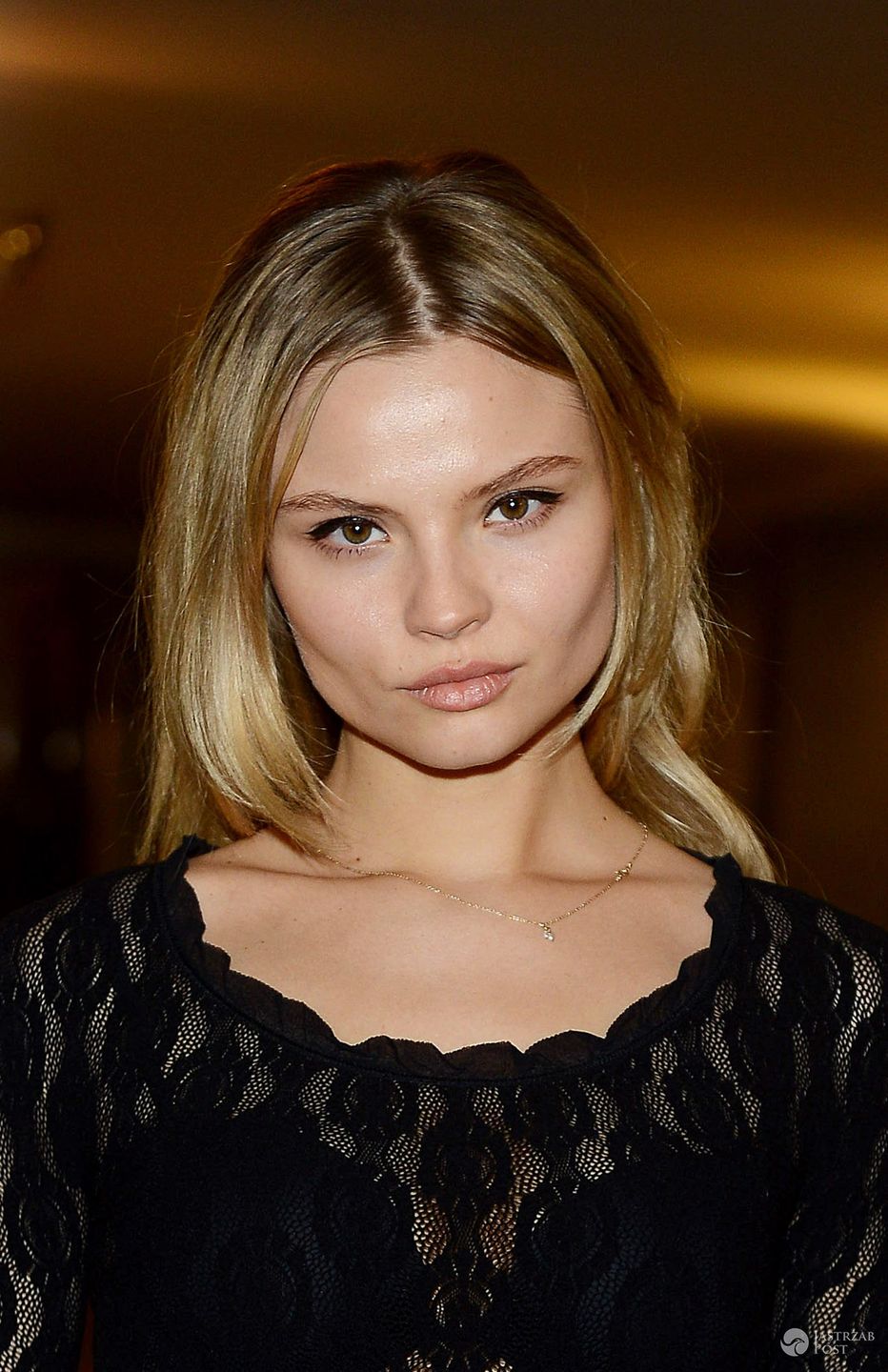 Magdalena Frąckowiak pokazała zdjęcia obrażeń po pobiciu