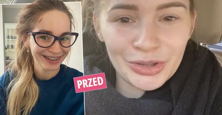 Ewelina Lisowska wcześniej ledwo otwierała usta, a teraz? Gwiazda pochwaliła się "nową twarzą". Zmiany widać gołym okiem. Ta metamorfoza zwala z nóg