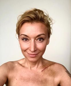Martyna Wojciechowska miała poważny wypadek na motocyklu!