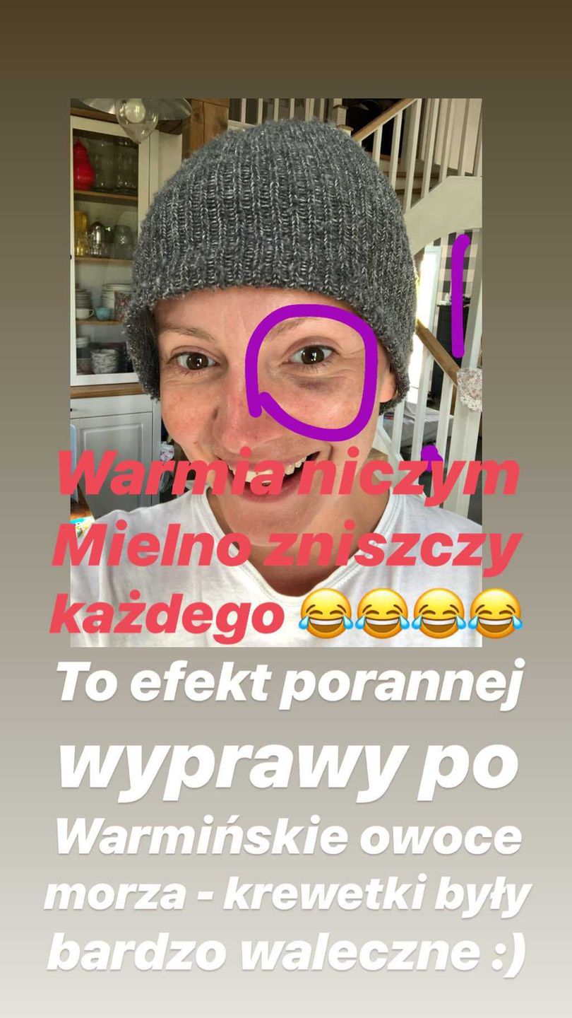 Dorota Szelągowska pokazała siniaka pod okiem