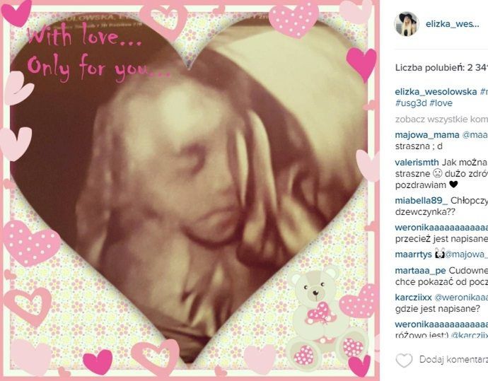Eliza Wesołowska pokazała zdjęcie USG swojej drugiej córki