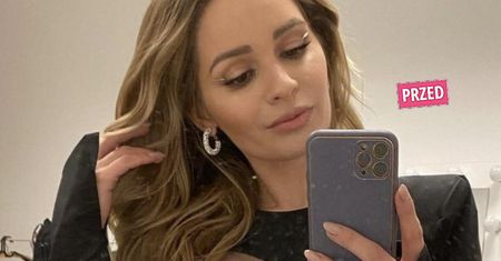 Ewelina Lisowska pokazała twarz po zabiegu. Ona ledwo otwiera usta! "Tak teraz wyglądam". Co jej się stało?