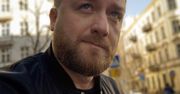 Bartek Kasprzykowski pokazał co dzieje się z jego ciałem po szczepieniu na Covid-19. Takich skutków ubocznych się nie spodziewał