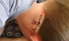 Szkocja: Polak zaatakowany nożem, bo nie poczęstował papierosem