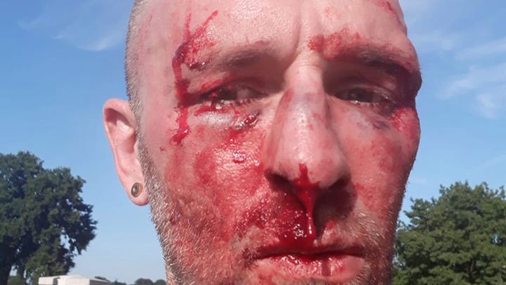 Maciej K. odpowiedzialny za pobicie dziennikarza Przemysława Witkowskiego został aresztowany