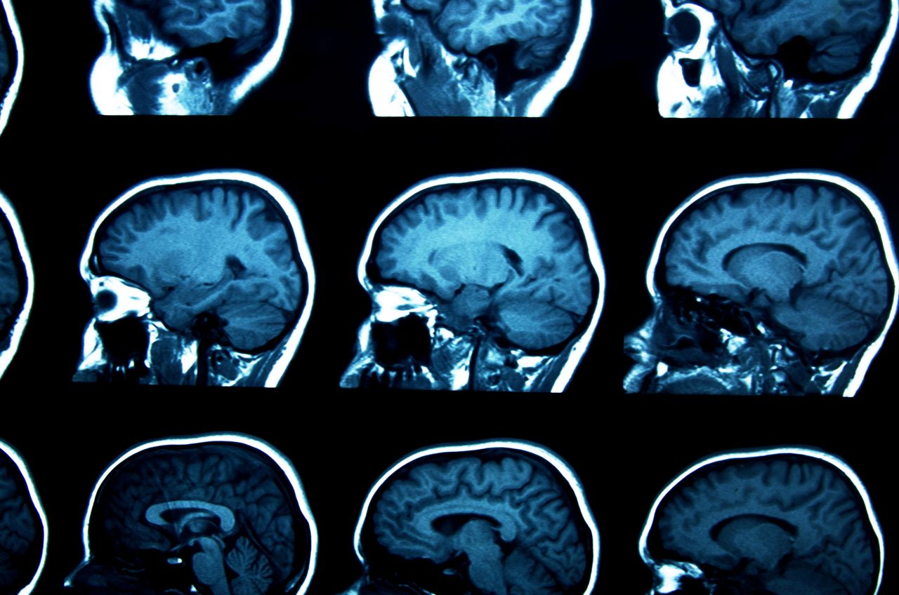 Śmierć. Mózg człowieka może działać nawet po zgonie. Nowe odkrycie naukowców