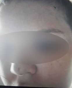 Sprawa 12-letniego Daniela z Podkarpacia. Ojciec nastolatka pozostanie w areszcie