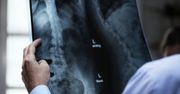 Materiał imitujący ludzką kość będzie ratunkiem dla osób zagrożonych amputacją