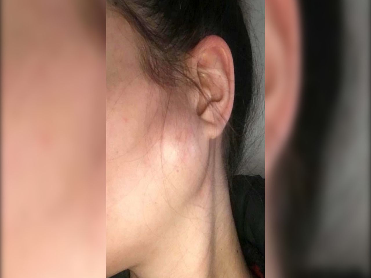 Objawy nowotworu gardła. Mogą pojawić się niespodziewanie