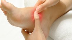 Domowe sposoby na otarcia stóp 