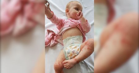 Niemowlę prawie umarło przez pocałunek