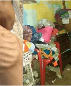 Przerażająca fala głodu w Wenezueli. Gwałtowny wzrost liczby przypadków niedożywienia wśród dzieci