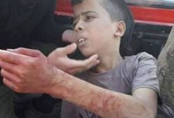 Obcięli 12-letniemu chłopcu głowę "przez pomyłkę"