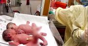 Niesamowite nagranie noworodków. Przestały płakać dopiero gdy... lekarz położył je obok siebie