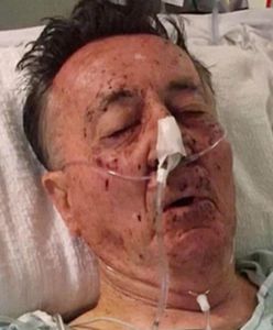 Fatalna pomyłka w New Jersey. Policjanci postrzelili 76-latka, bo trafili pod zły adres