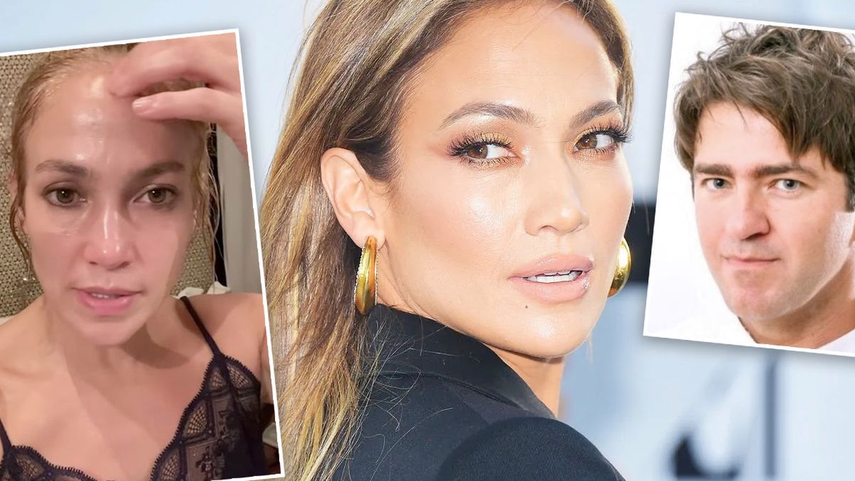 Lekarz polskich gwiazd ocenił twarz Jennifer Lopez. Stosuje botoks? Wnioski są zadziwiające