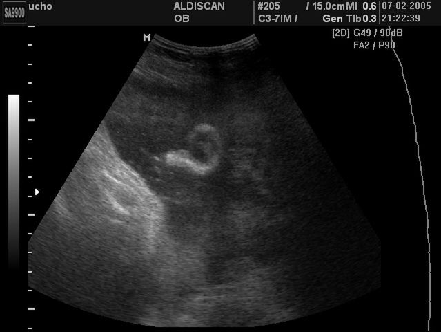 Zdjęcia płodu - ucho dziecka w 33 tygodniu ciąży 