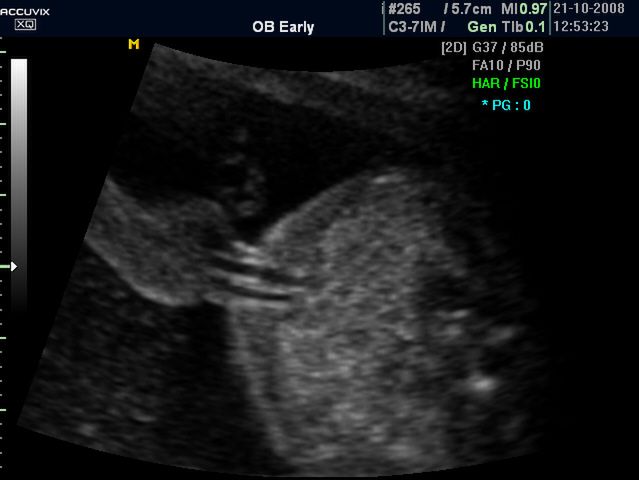 Zdjęcia płodu - 29 tydzień ciąży 