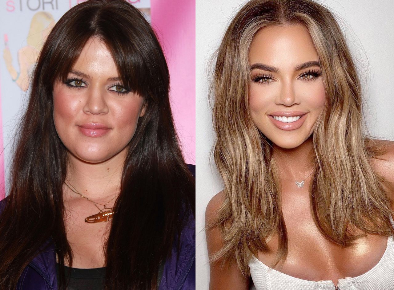 Khloe Kardashian przed i po operacji nosa