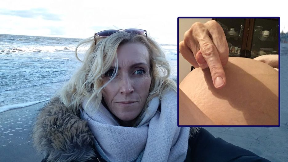 Monika Baumann zdecydowała się odpowiedzieć Joannie Lichockiej. Nigdy wcześniej nie pokazywała swojego brzucha, w którym rośnie nowotwór