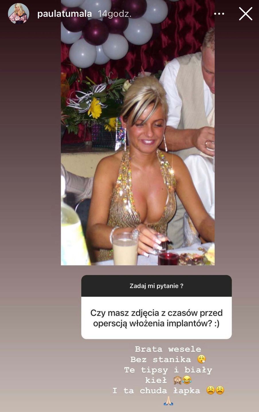Paula Tumala przed powiększeniem piersi