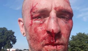 Wrocław. Mężczyzna podejrzany o atak na dziennikarza zatrzymany