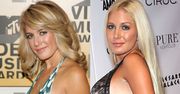 Heidi Montag: największa ofiara operacji plastycznych w Hollywood