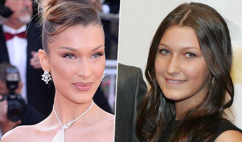 Bella Hadid - po i przed korektą ust