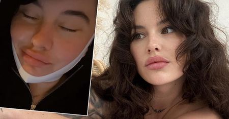 Ola Żuraw z "Top Model" przeszła rozległą operację. "Ledwo żyję, wyłam z bólu". Opisała w jakim jest stanie i pokazała zdjęcia