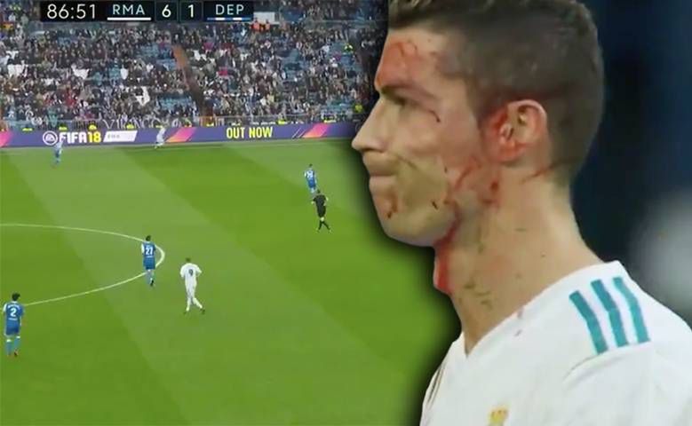 Ronaldo miał wypadek podczas ostatniego meczu