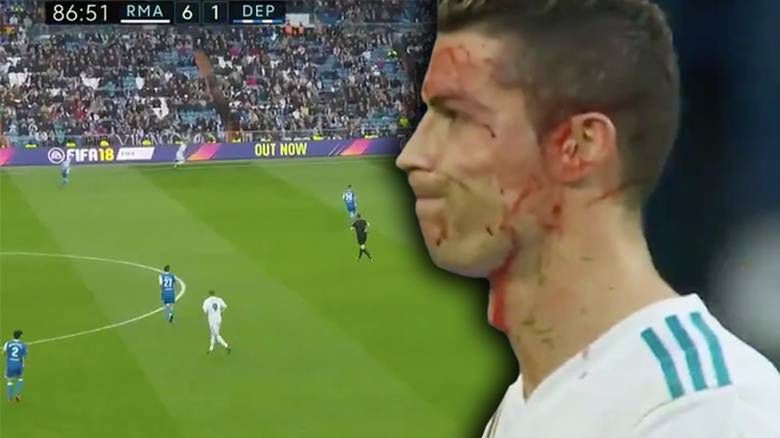 Ronaldo miał wypadek podczas ostatniego meczu