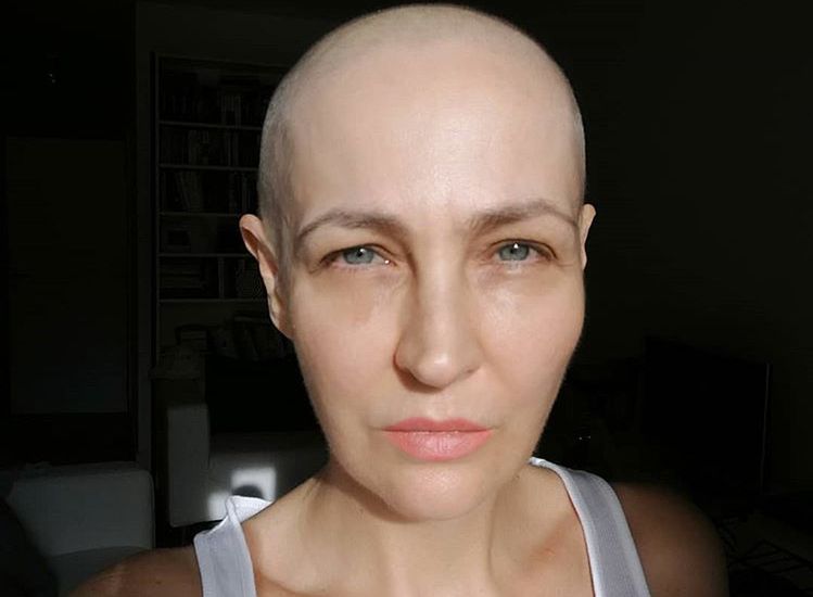 Anna Puślecka choruje na raka. Może liczyć na wsparcie gwiazd
